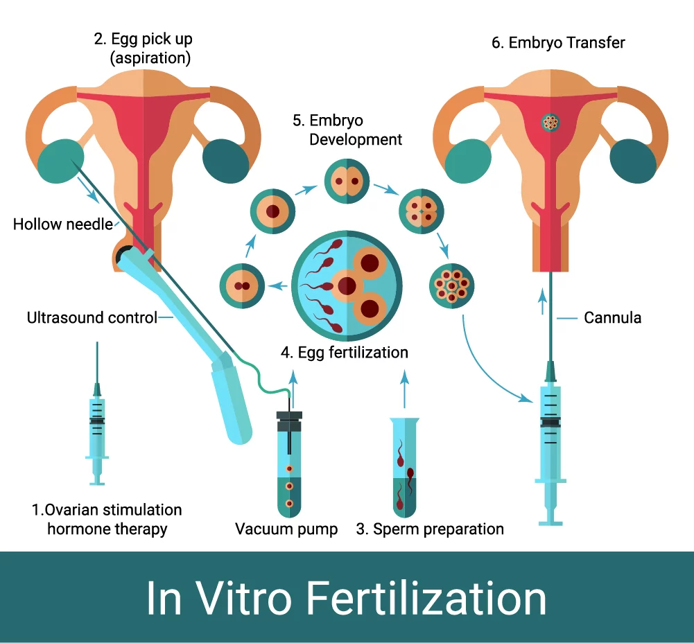 Best IVF Centre in Gurgaon